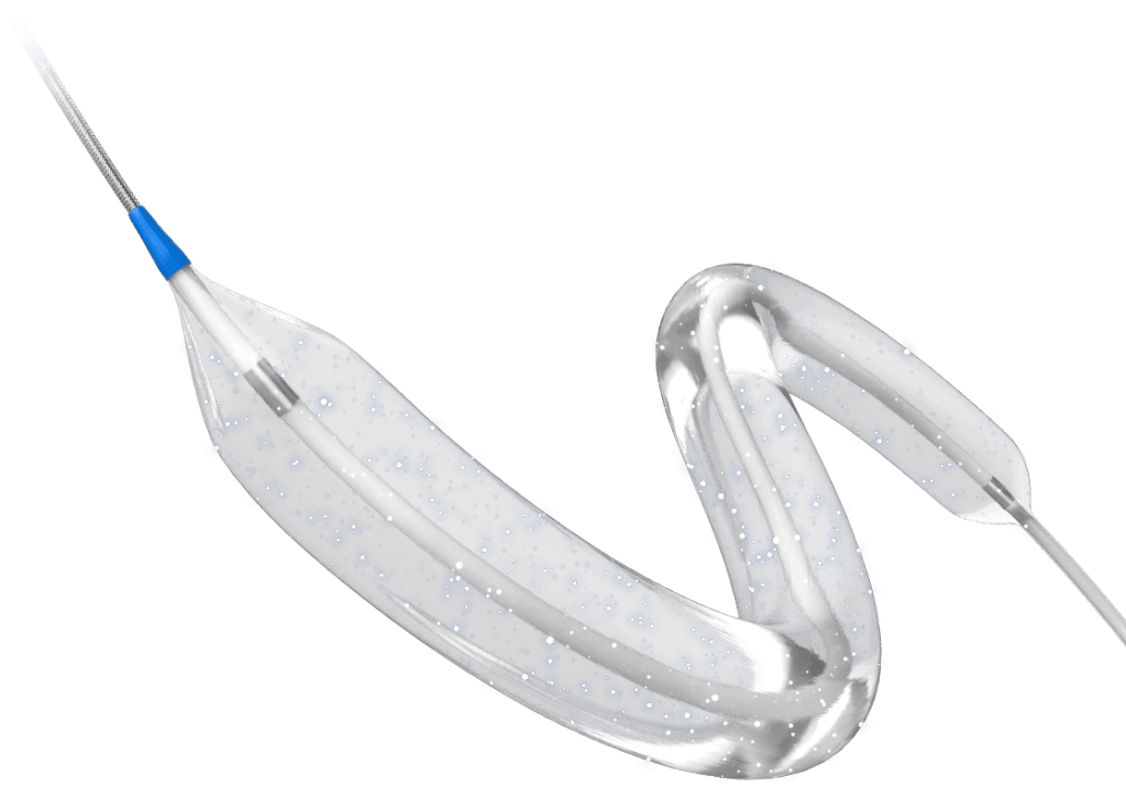 Sirolimus-coated balloon good alternative to stents: Cardiologists sirolimus-coated-balloon-good-alternative-to-stents:-cardiologists