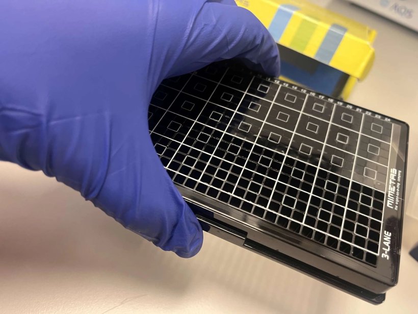 new-placenta-on-a-chip-model-to-address-preeclampsia-in-pregnancy