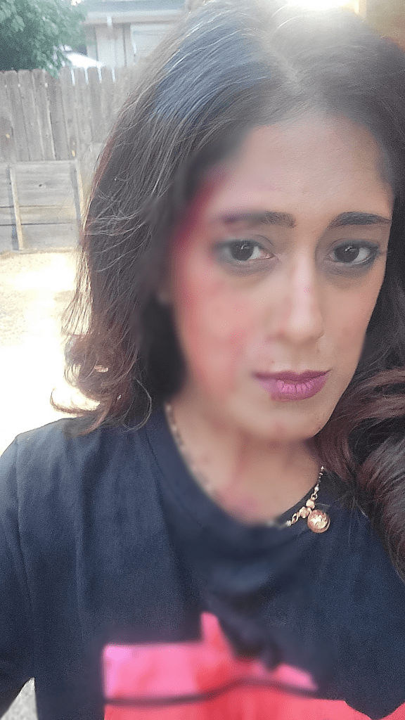 leader-of-indo-lankan-descent-attacked-in-violent-carjacking-in-us