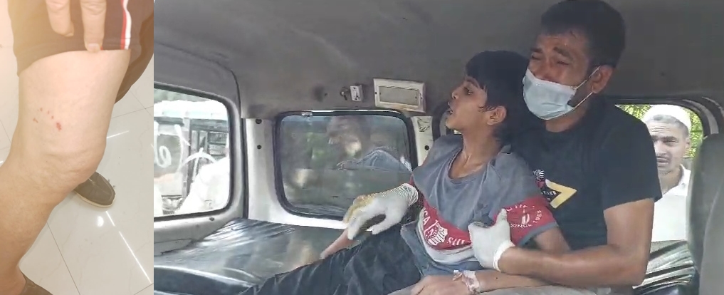 Boy’s death stokes rabies fears in Noida-Ghaziabad as strays run amok boy’s-death-stokes-rabies-fears-in-noida-ghaziabad-as-strays-run-amok