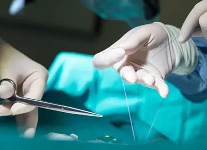 India surgical sutures market to grow to $380 mn in 2030: Report india-surgical-sutures-market-to-grow-to-$380-mn-in-2030:-report