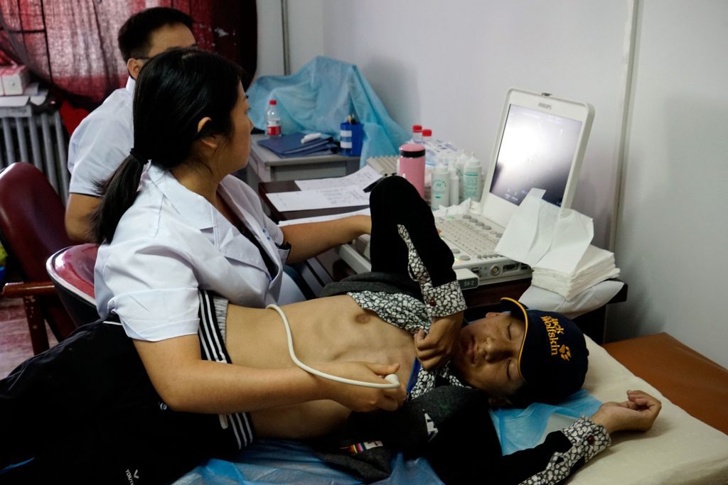 Women less likely to go for cardiovascular rehabilitation programme: Study women-less-likely-to-go-for-cardiovascular-rehabilitation-programme:-study