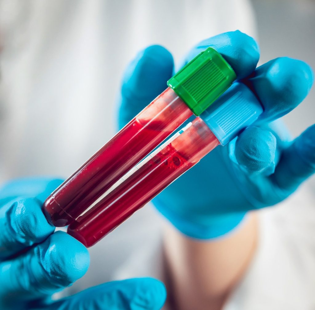new-blood-test-may-detect-ovarian-cancer-early-with-91%-accuracy