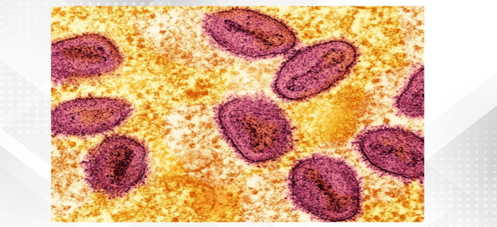 Philippines detects first mpox case this year, yet to determine strain