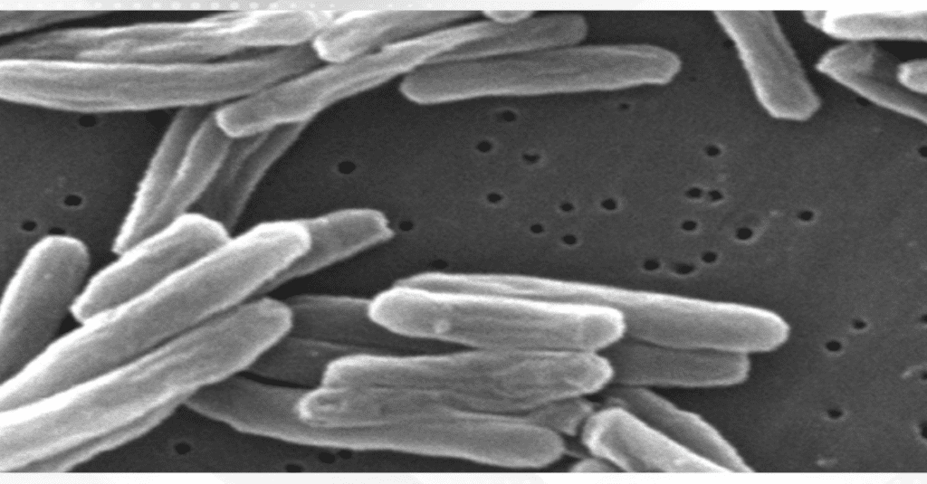 Tuberculosis cases in the US rose to their highest levels in more than a dozen years